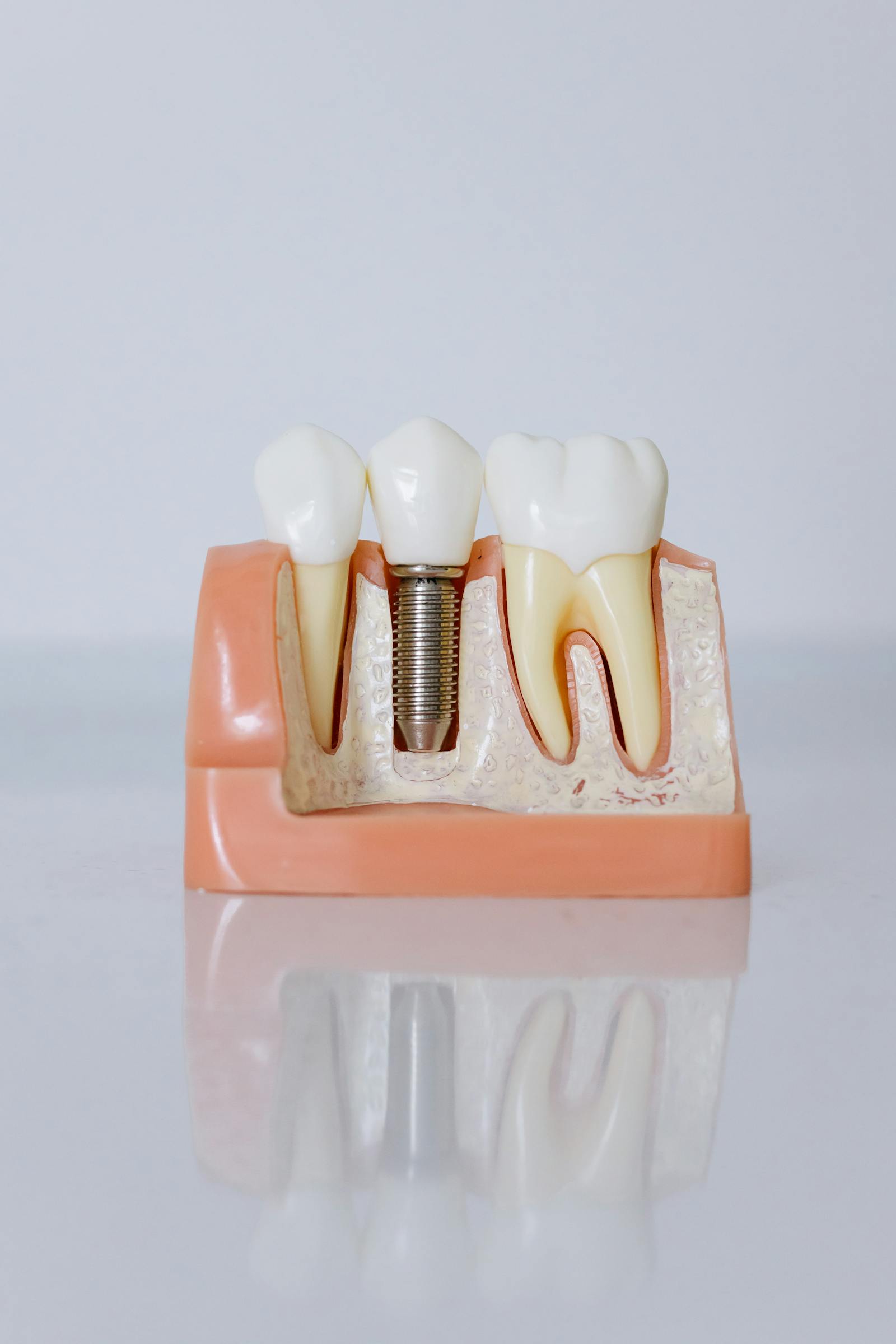 Patient smile before treatment